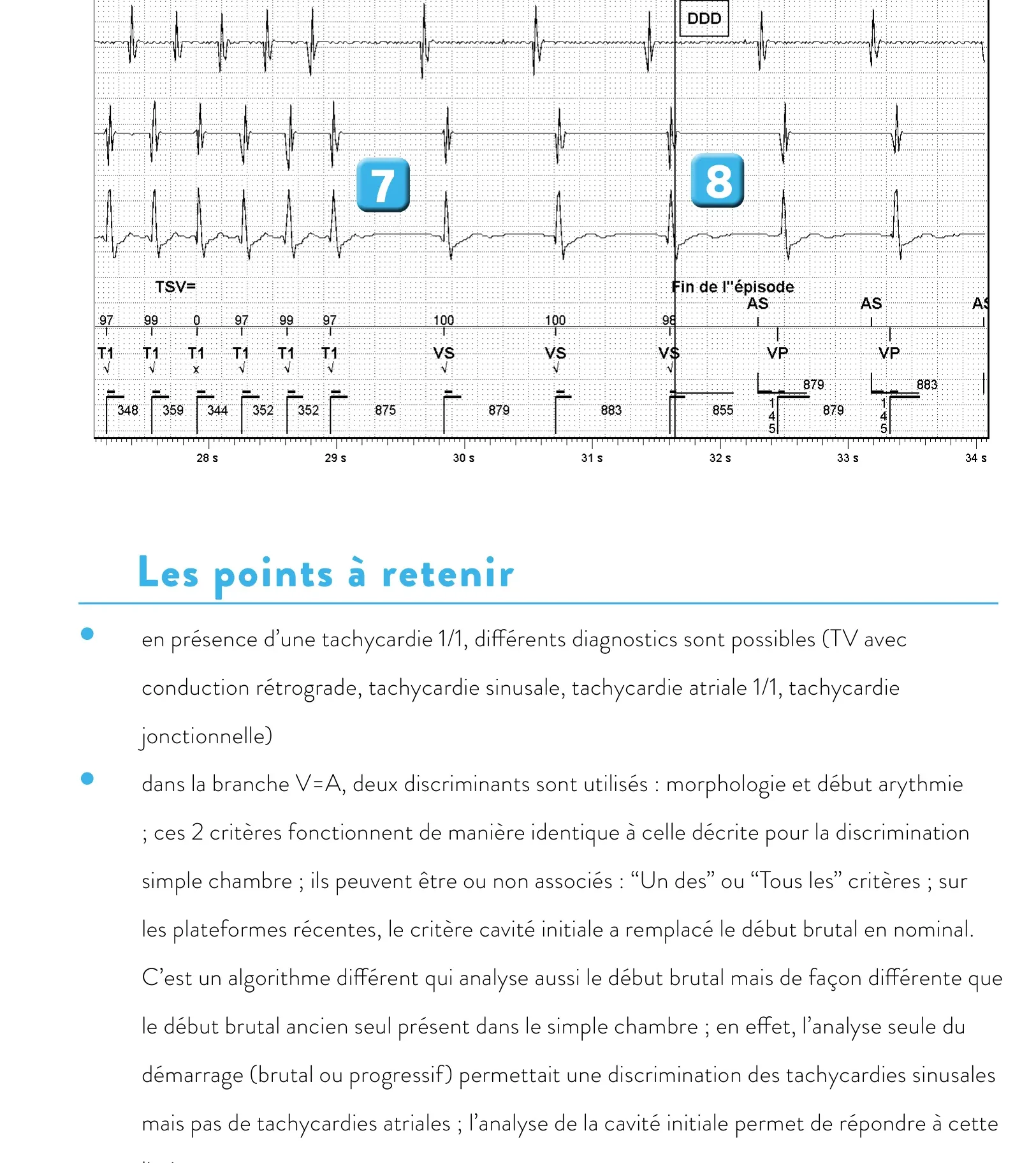 Discrimination double chambre et branche V = A