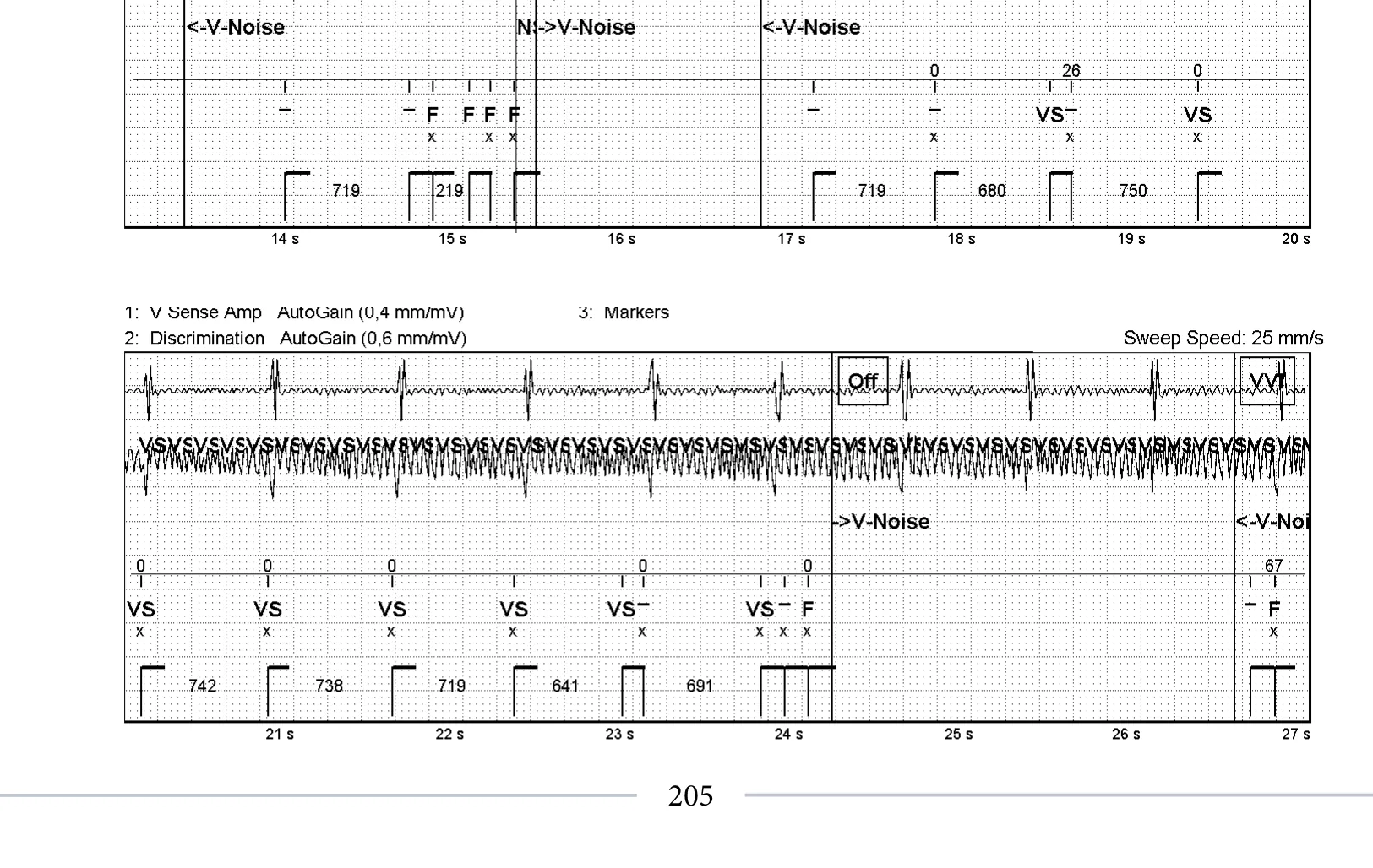 Surdétection d’un signal 50 Hz