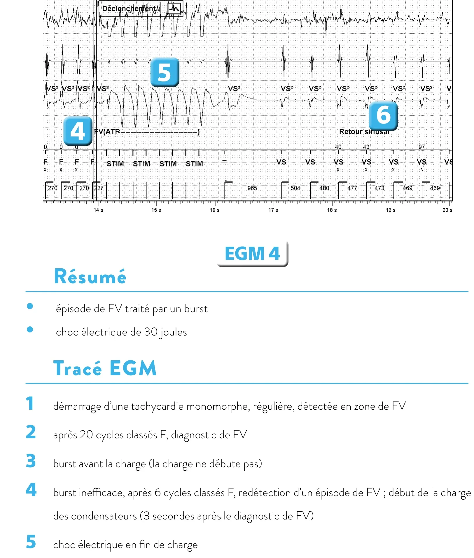 Stimulation anti-tachycardique pendant ou avant la charge en zone de FV