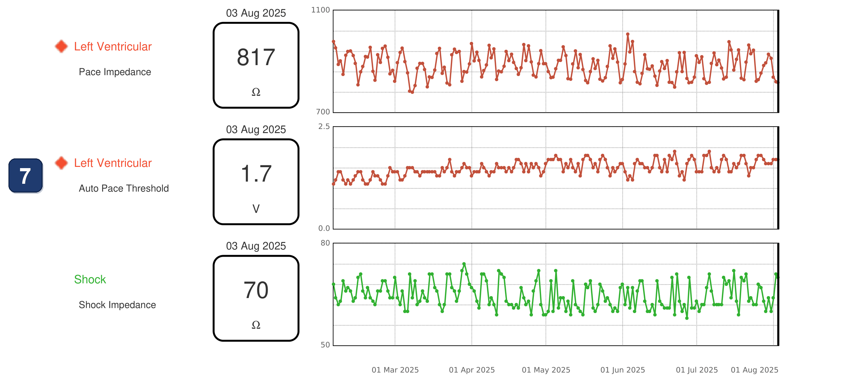 Électrogramme Boston Scientific CRT, segment 3/4 — Lire un rapport de suivi LATITUDE complet de CRT-D
