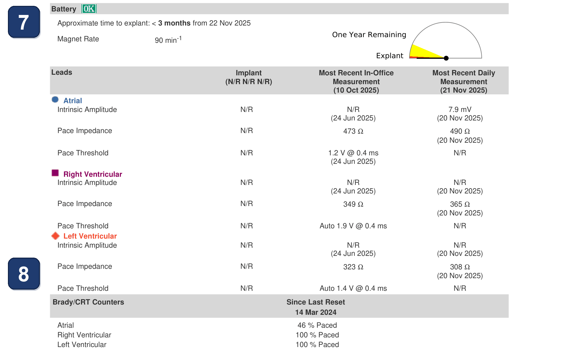 Électrogramme Boston Scientific CRT, segment 5/7 — Alerte d'impédance VG hors limites en fin de vie de pile