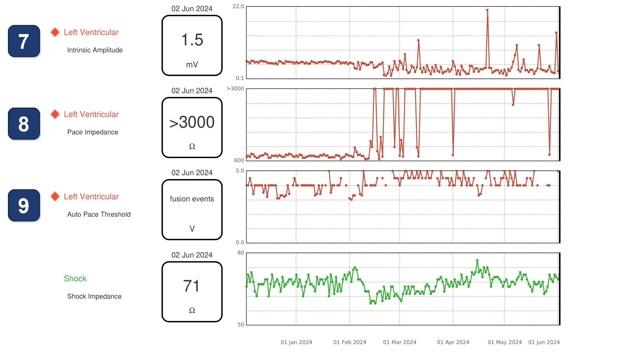 Électrogramme Boston Scientific CRT, segment 4/4 — Battements intermittents stimulés en VD seul chez un CRT-D RESONATE