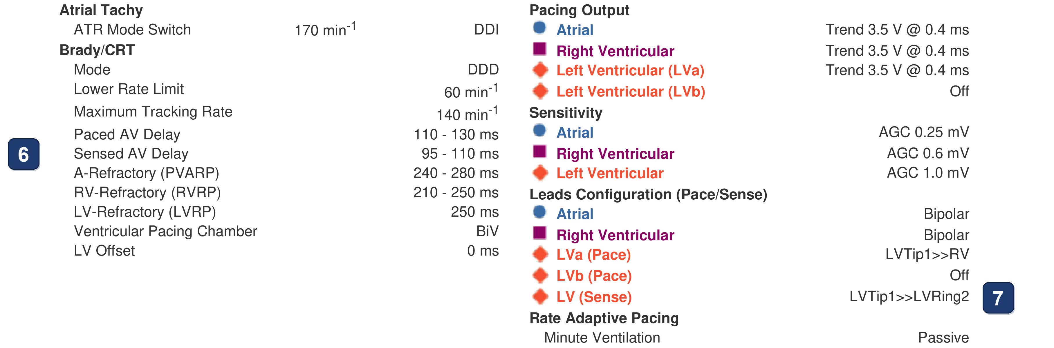 Électrogramme Boston Scientific CRT, segment 3/3 — Perte intermittente de la stimulation VG malgré 99 % de stimulation VD