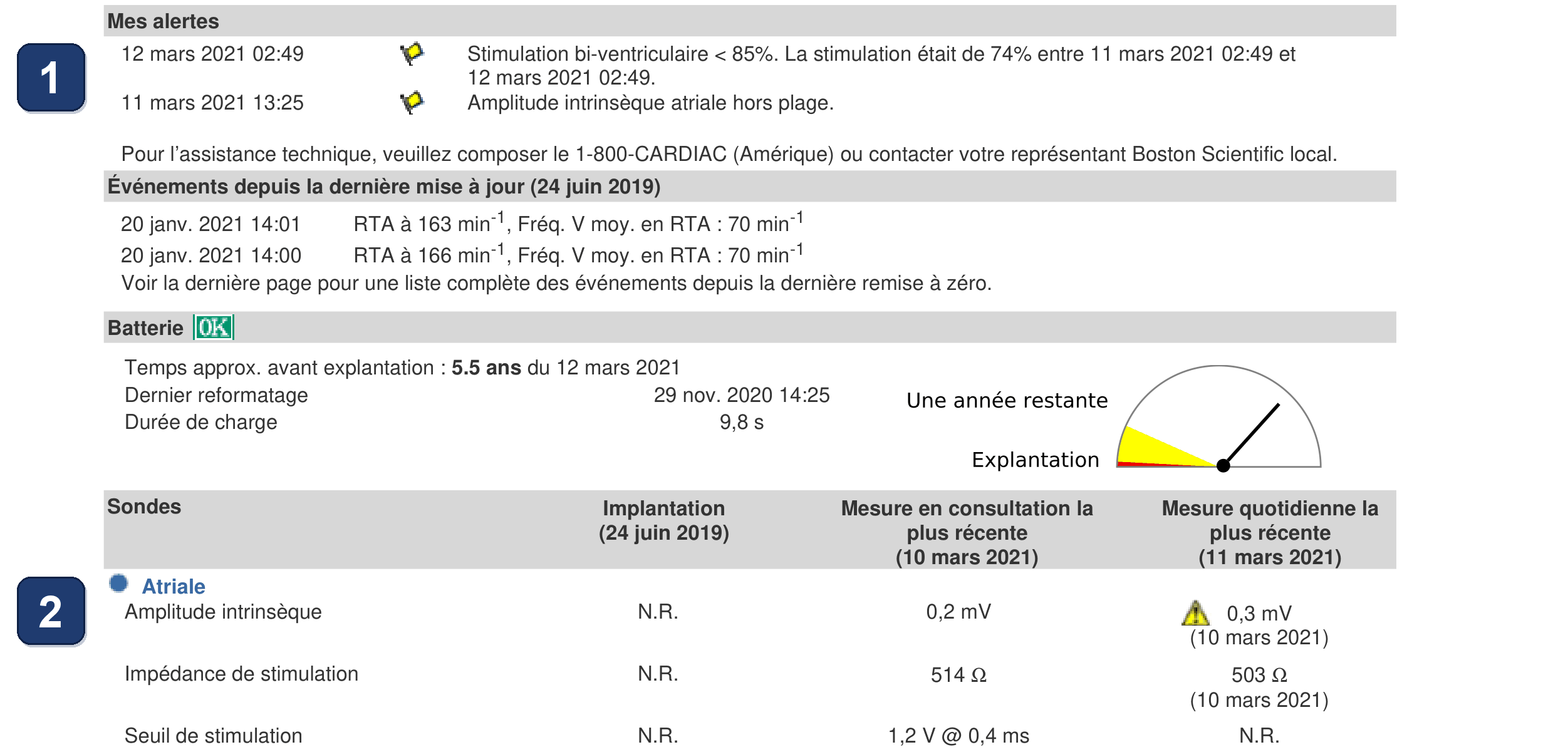 Électrogramme Boston Scientific CRT, segment 1/4 — Chute de la CRT et événements atriaux de faible amplitude