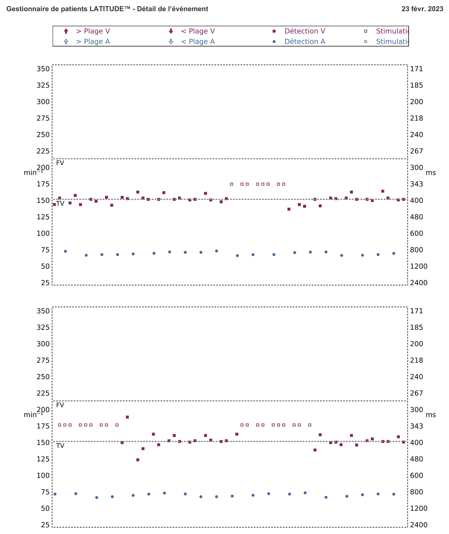 Figure — Choc à faible amplitude et accélération de l’arythmie