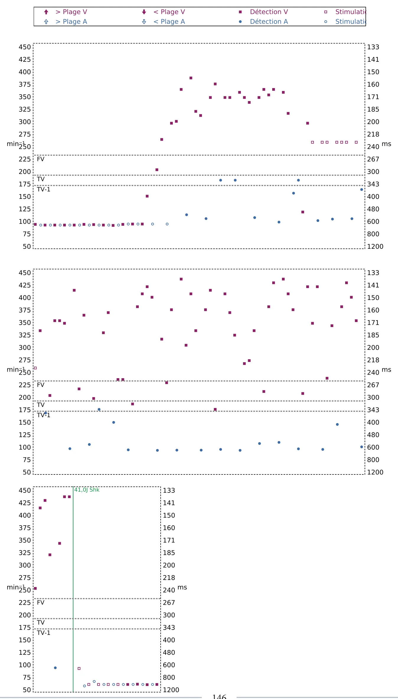 Figure — Sous-détection, erreur de calcul de la fréquence et salve d’ATP en zone de FV