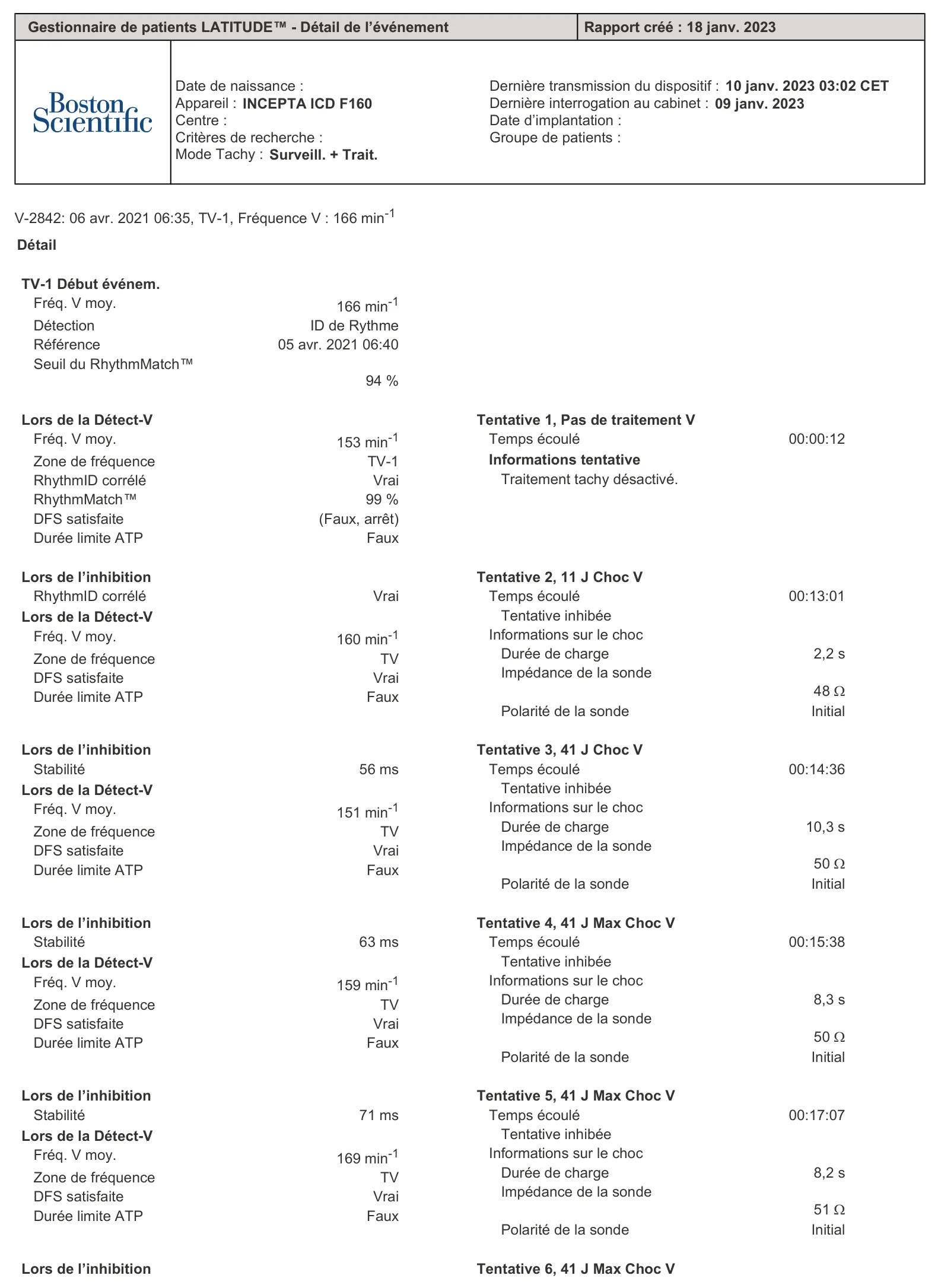 Figure — Discrimination simple chambre, ID de rythme et DFS