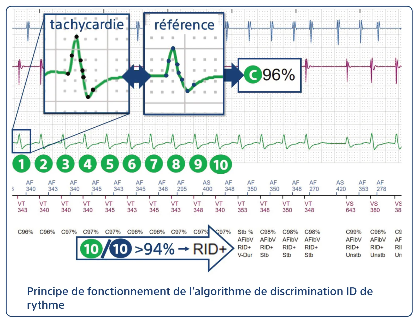 Principe de fonctionnement de l’algorithme de discrimination ID de rythme
