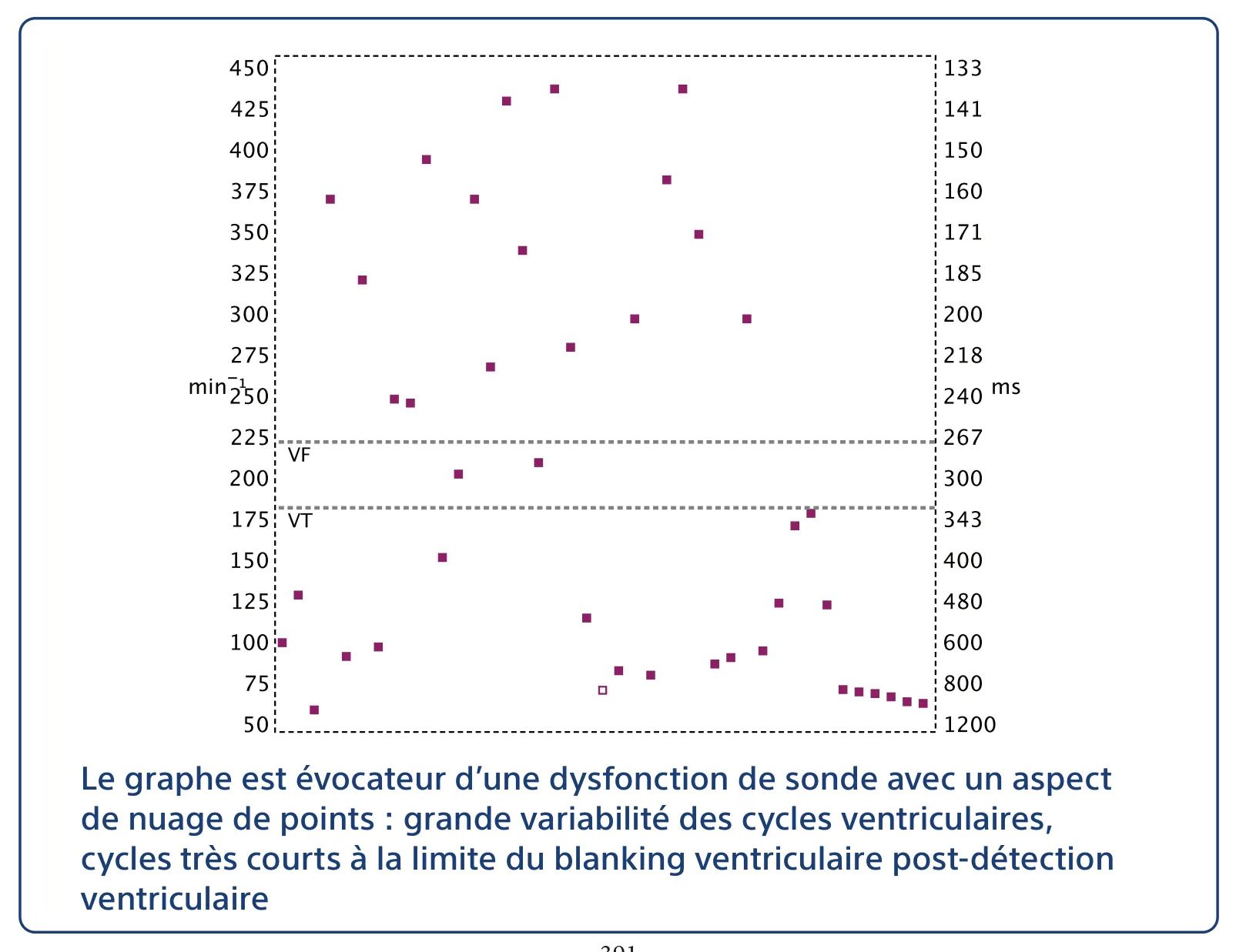 Le graphe est évocateur d’une dysfonction de sonde avec un aspect de nuage de points : grande variabilité des cycles ventriculaires, cycles très courts à la limite du blanking ventriculaire post-détection ventriculaire