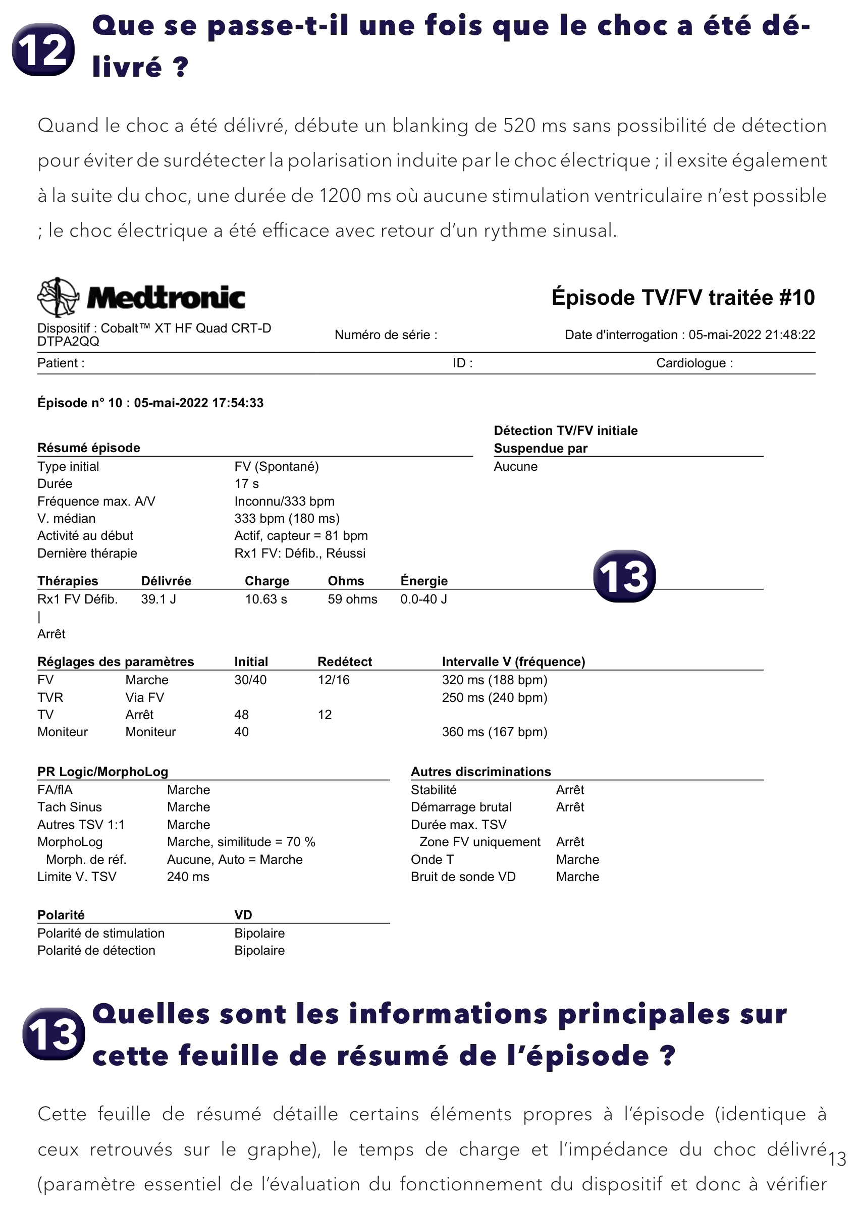 Électrogramme Medtronic DAI, segment 1 sur 1 — Analyse d’un tracé de FV enregistré par le dispositif