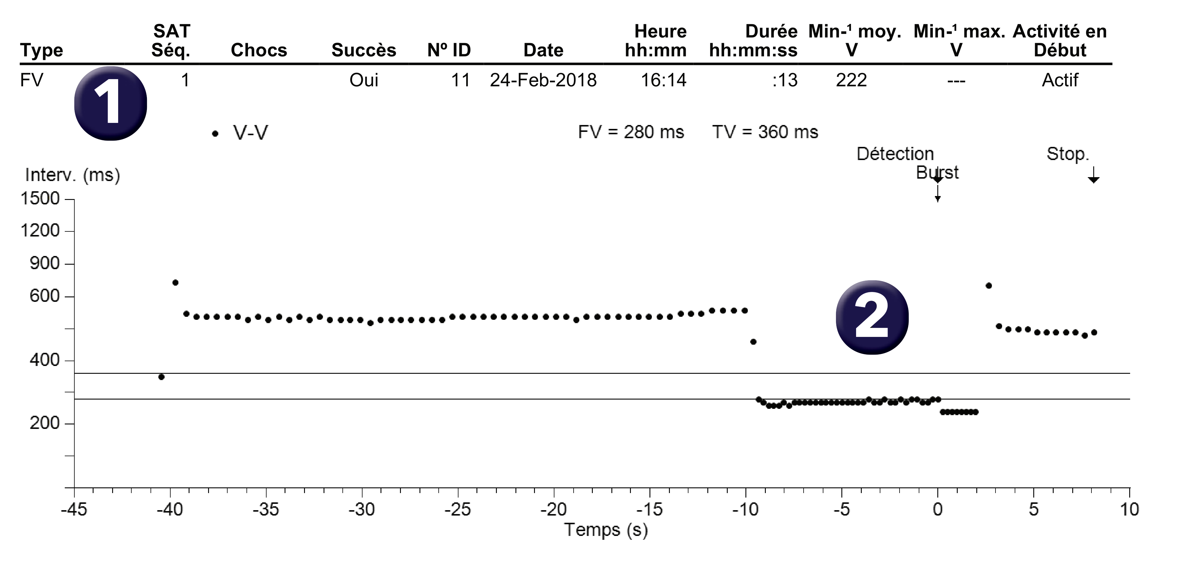 Électrogramme Medtronic DAI, segment 1 sur 1 — Compteur combiné