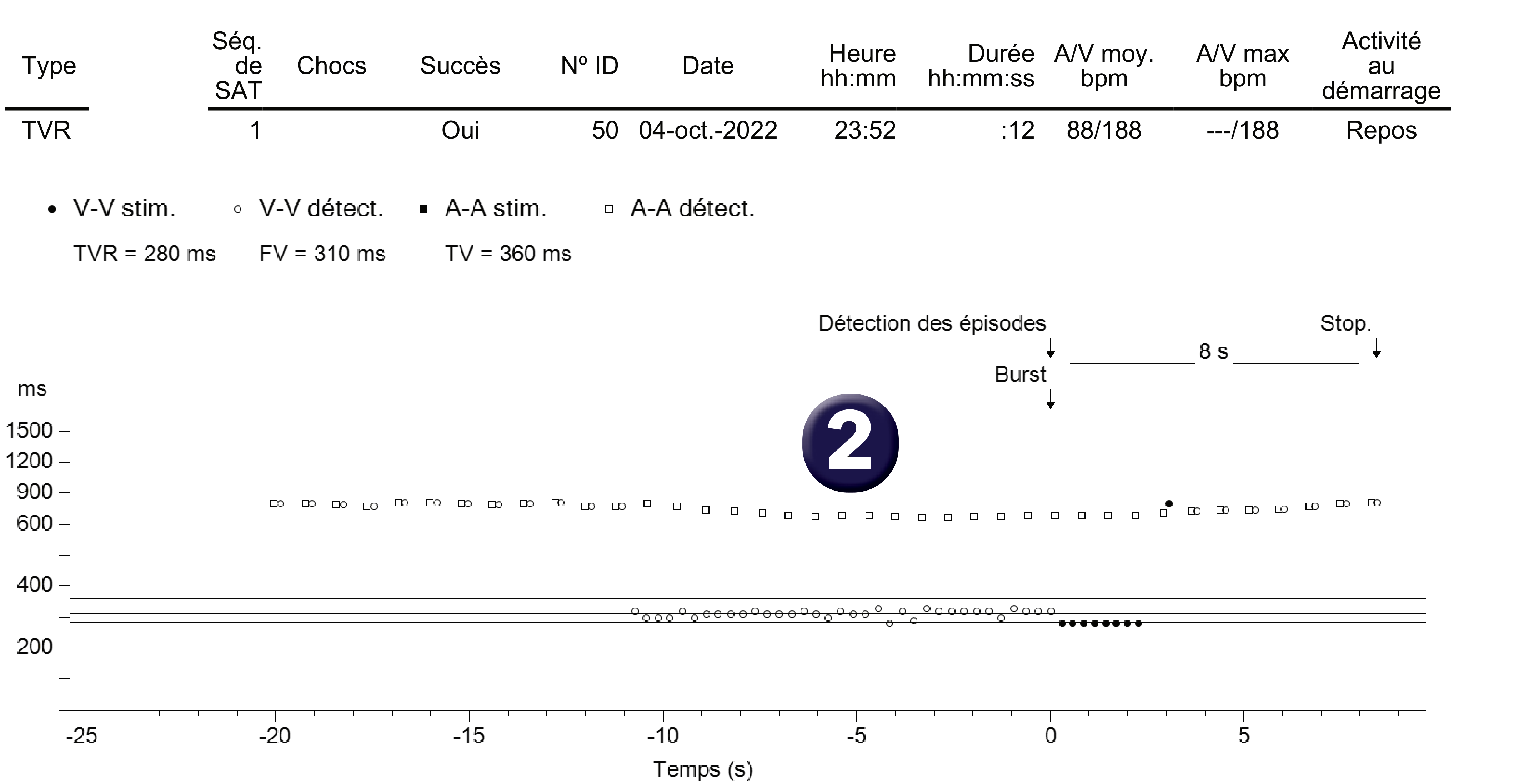 Électrogramme Medtronic DAI, segment 1 sur 2 — TV rapide et compteur combiné