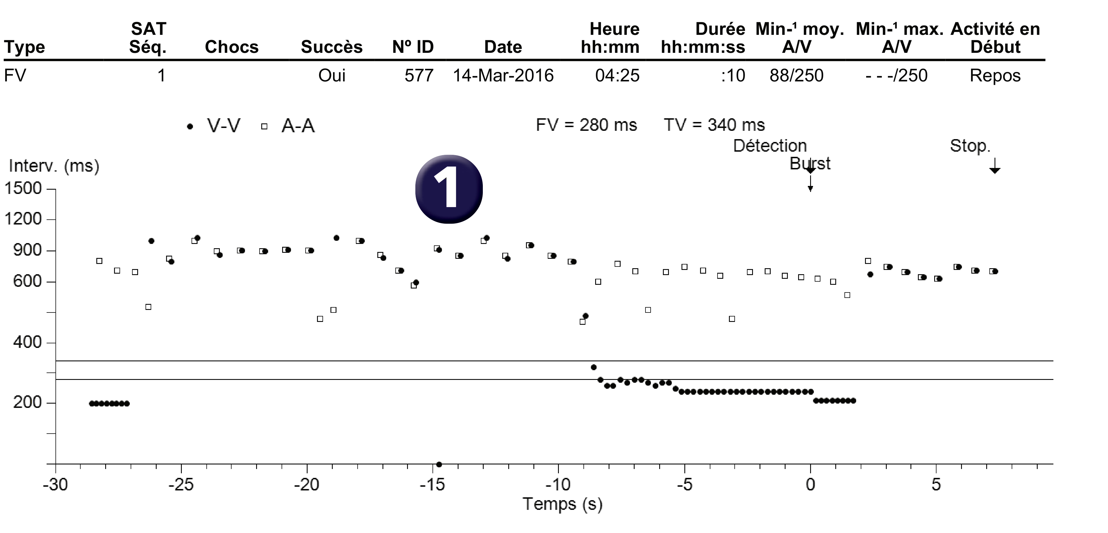 Électrogramme Medtronic DAI, segment 1 sur 1 — Stimulation anti-tachycardique en zone de FV et économie d’énergie