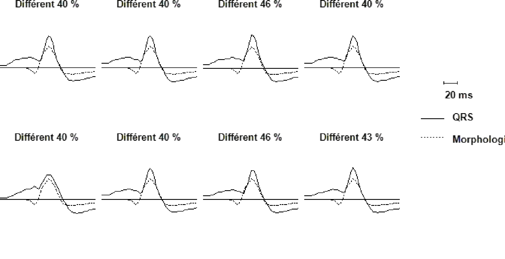 Wavelet overview