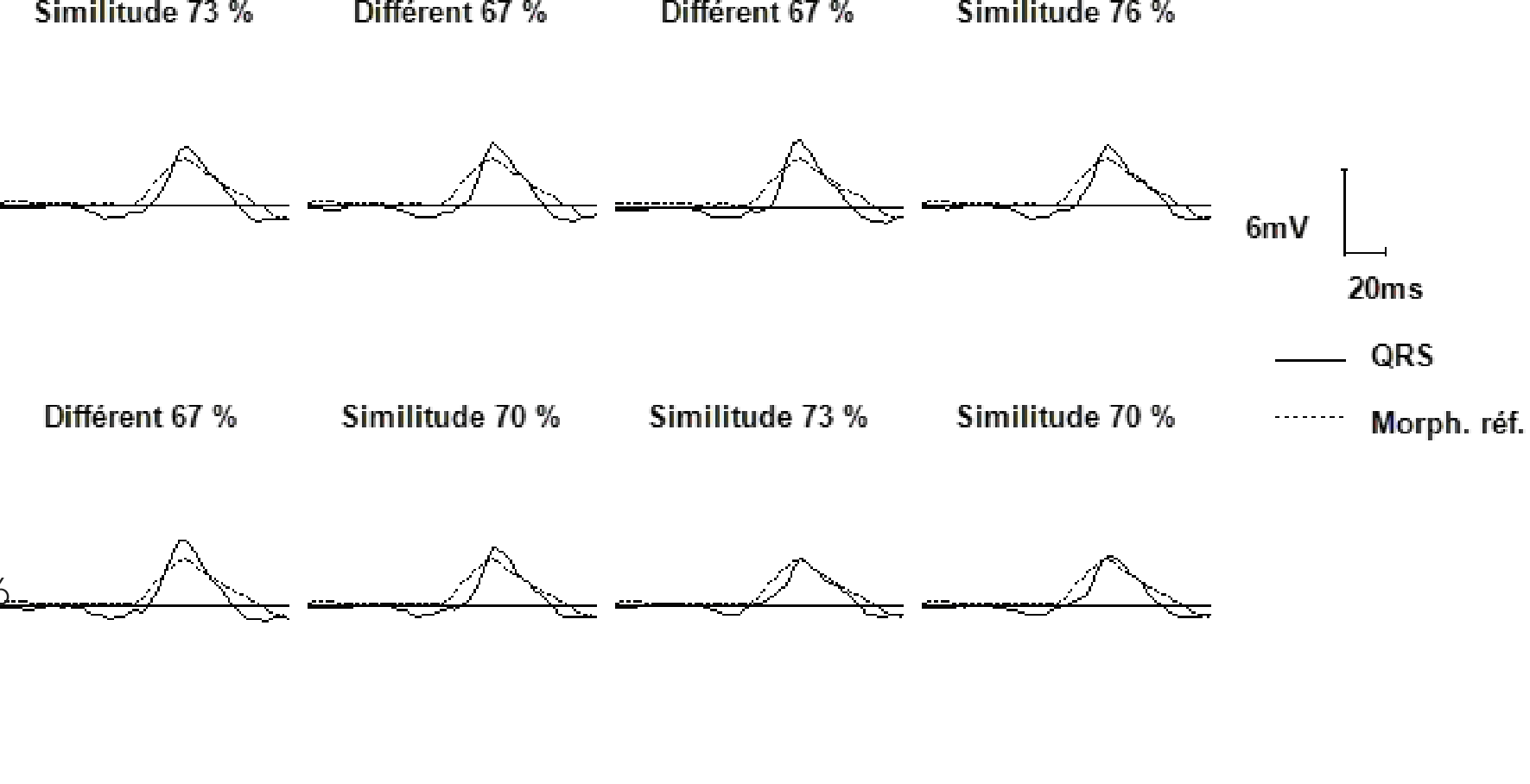 Wavelet overview