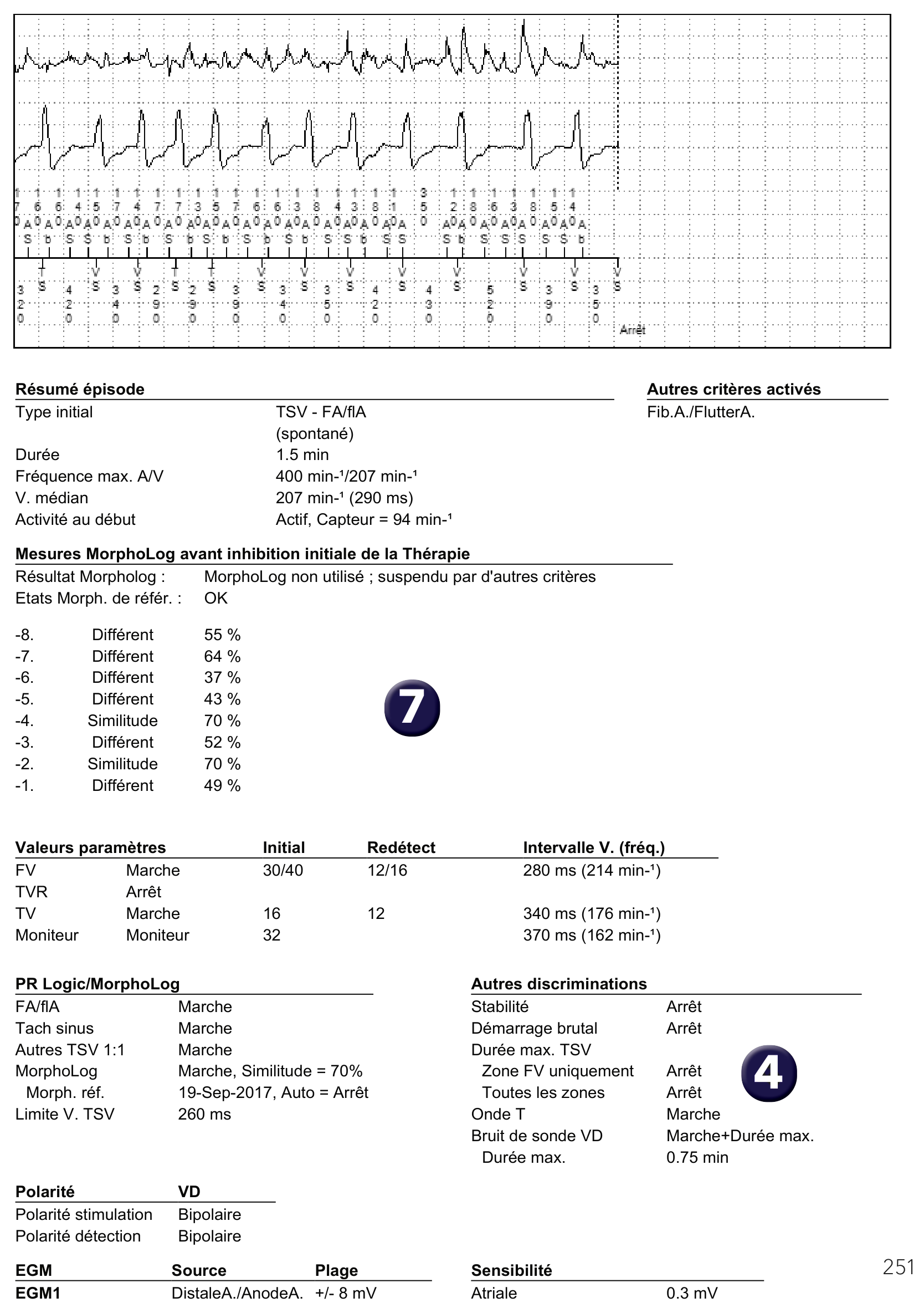 Électrogramme Medtronic DAI, segment 2 sur 2 — FA conduite, PR Logic et MorphoLog