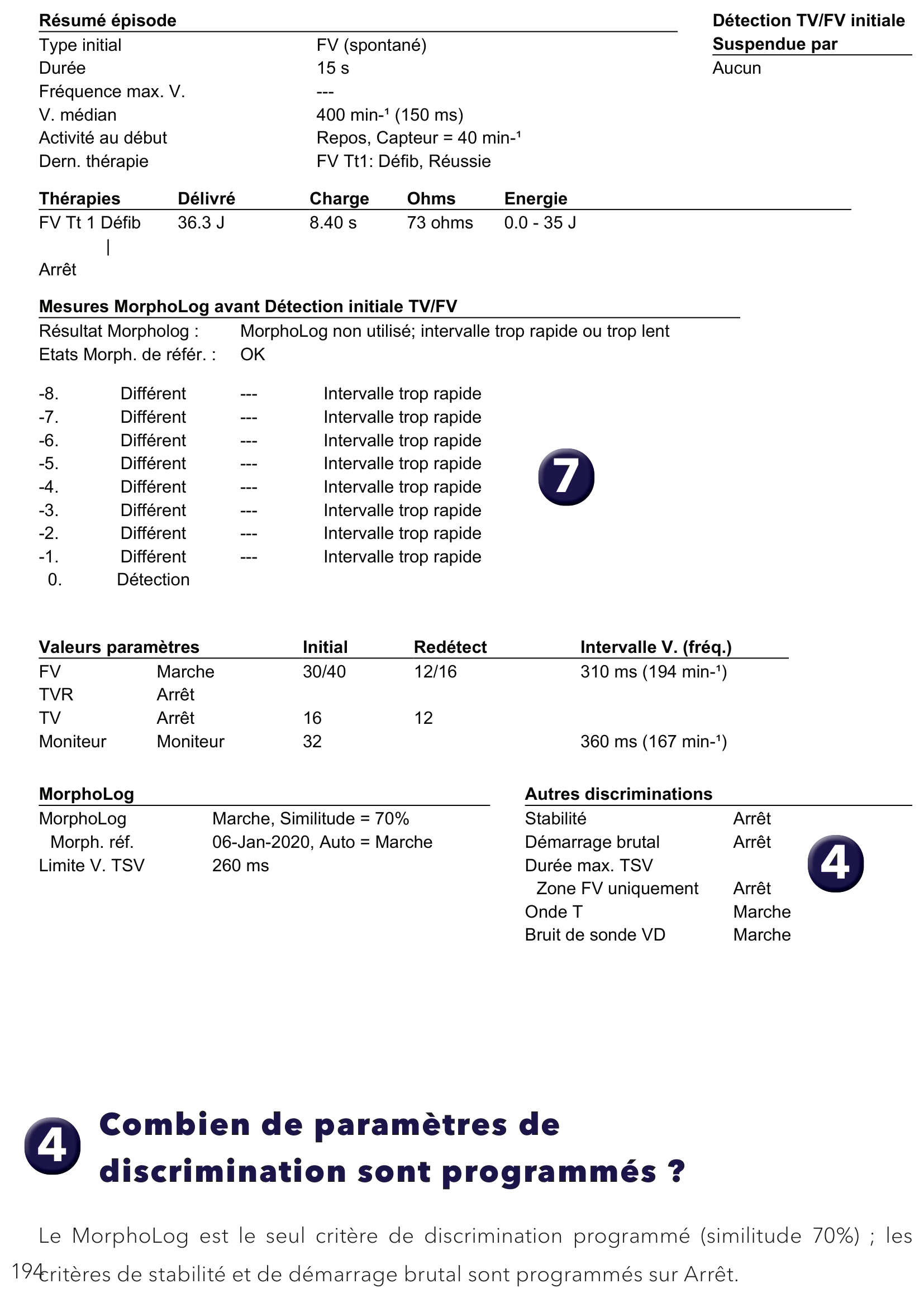 Électrogramme Medtronic DAI, segment 1 sur 1 — Défibrillateur simple chambre et limite V.TSV
