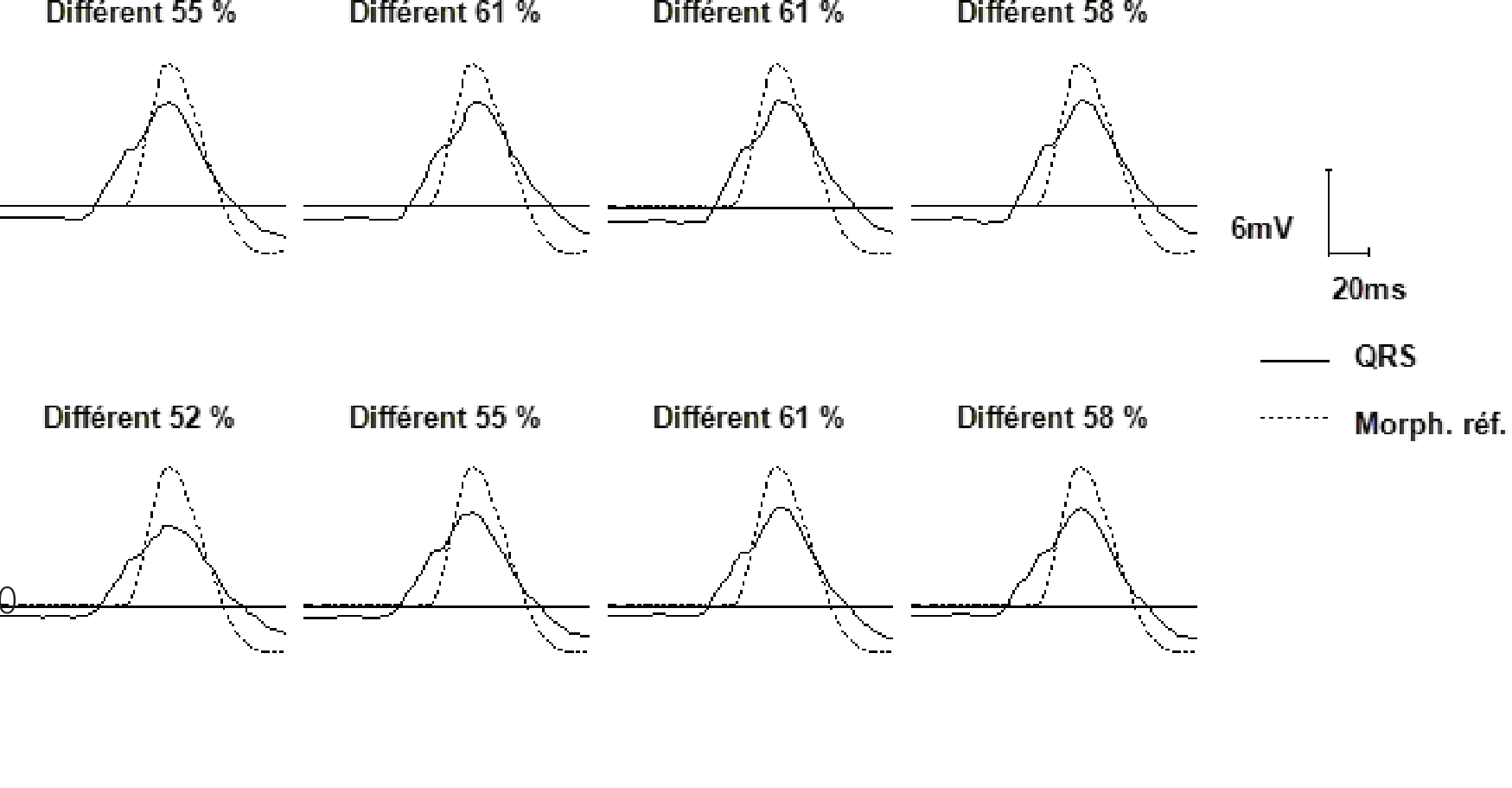 Wavelet overview