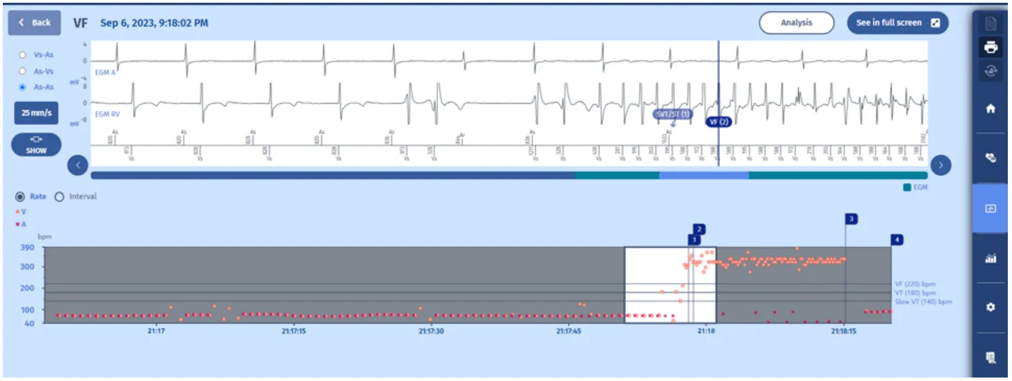 MicroPort DAI, Revue d’épisodes — Compteur et diagnostic de la FV