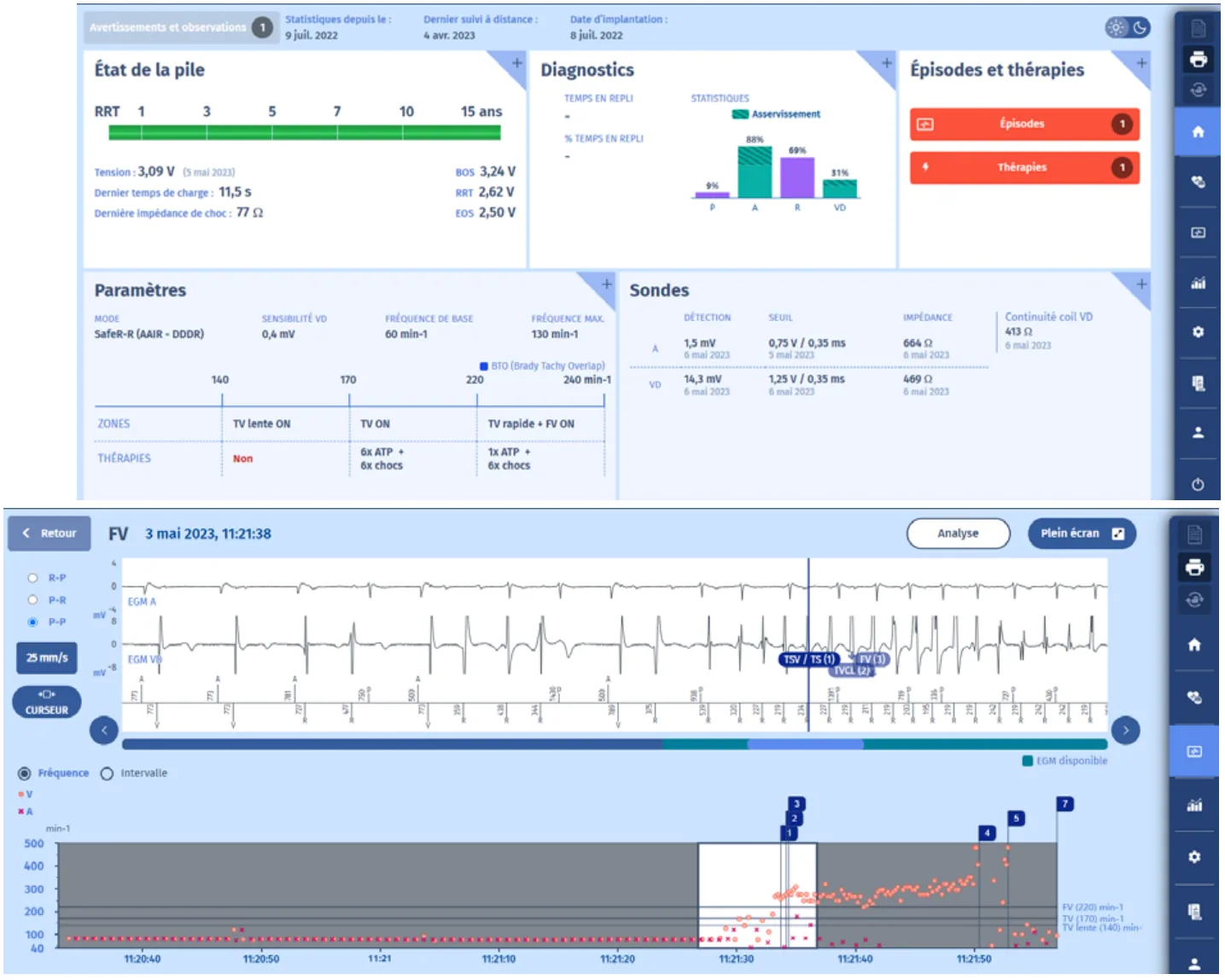 MicroPort DAI, Ecran de résumé — Compteurs concurrents