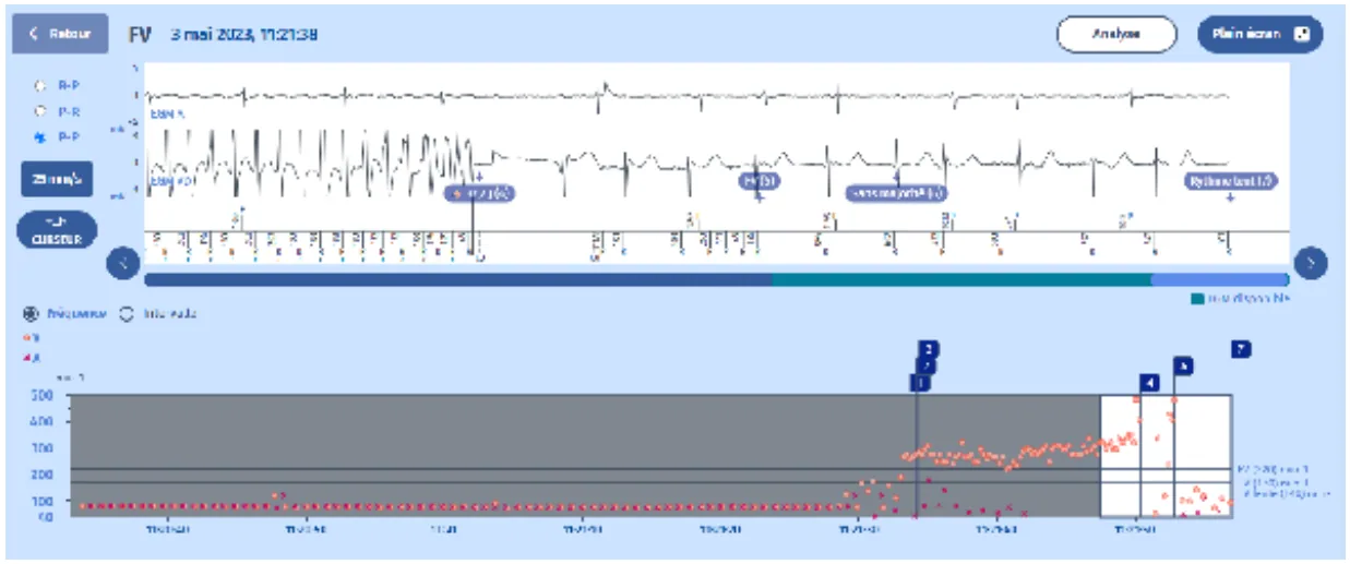 MicroPort DAI, EGM — Compteurs concurrents