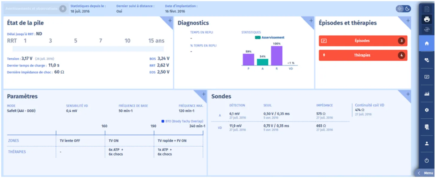 MicroPort DAI, Vous interrogez l’appareil — Tachycardie traitée par une SAT de type burst