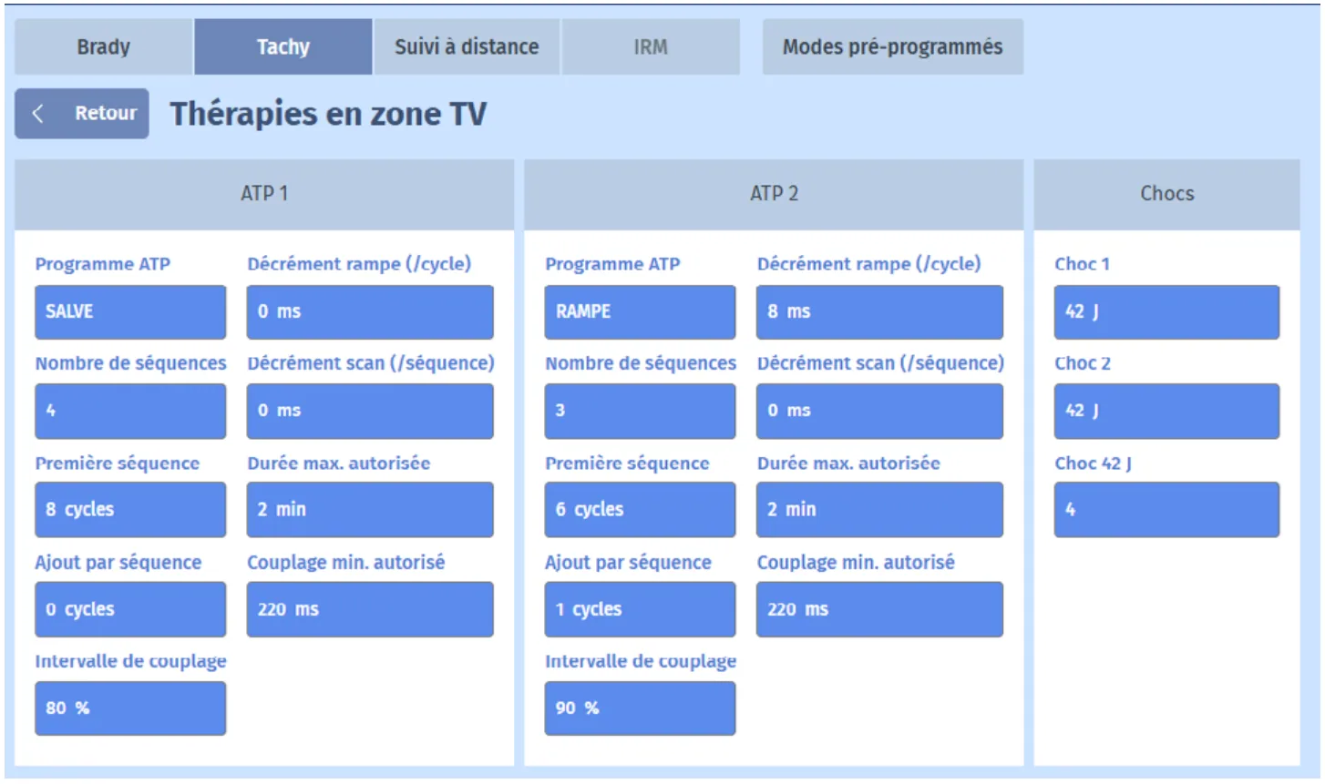 MicroPort DAI, Programmation — Tachycardie traitée par une salve de SAT