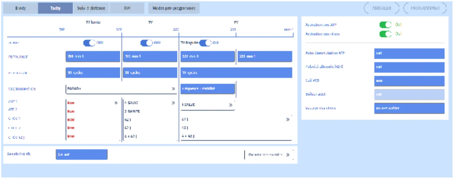 MicroPort DAI, Programmation — Tachycardie et zones