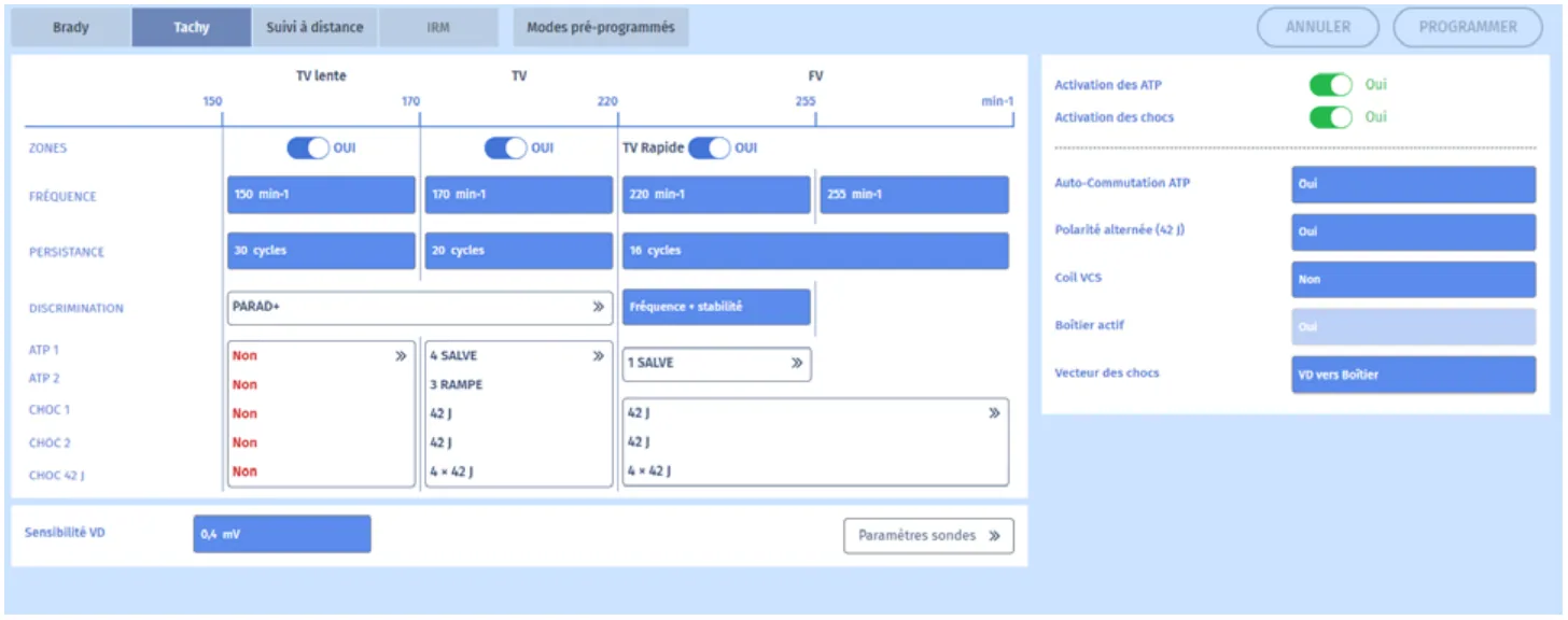 MicroPort DAI, Programmation — Arrêt de la tachycardie par la SAT ?