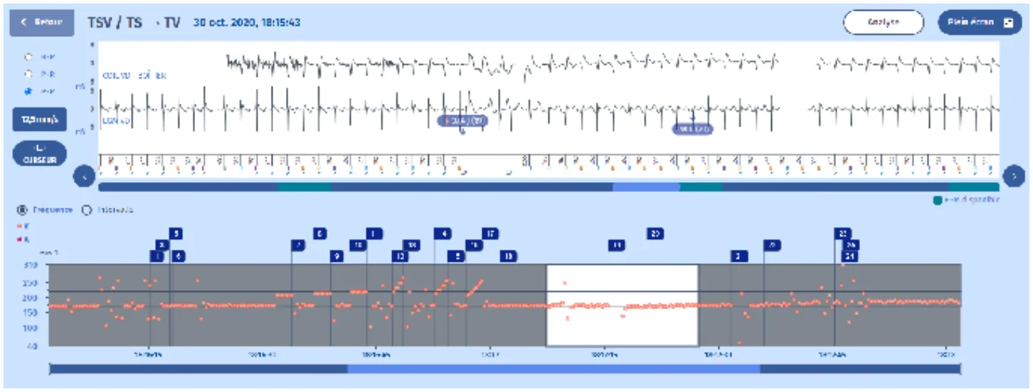 MicroPort DAI, EGM — La morphologie