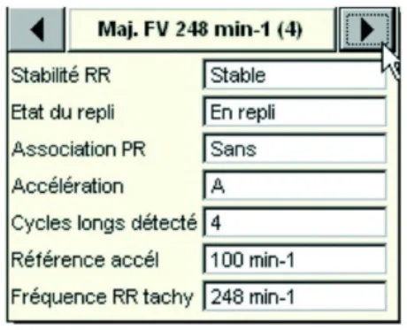 MicroPort DAI, Commentaires — Bitachycardie ?