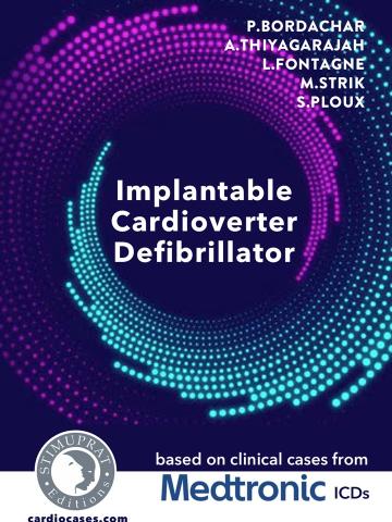 Implantable Cardioverter Defibrillator Medtronic Implantable Cardioverter Defibrillator Medtronic