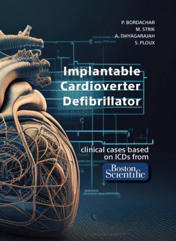 Boston Implantable Cardioverter Defibrillator
