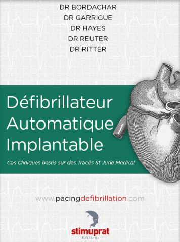 Défibrillateur Automatique Implantable