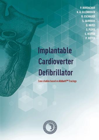 Abbott Implantable Cardioverter Defibrillator