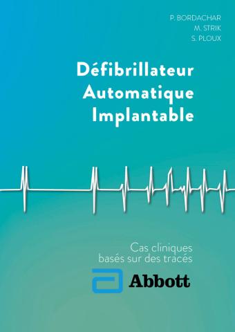 Défibrillateur Automatique Implantable Abbott