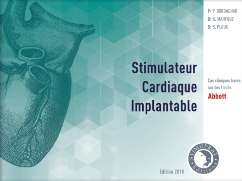 Stimulateur Cardiaque Implantable Abbott