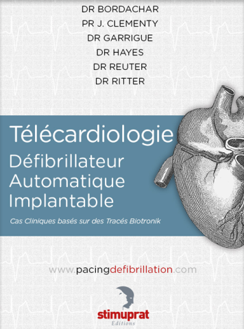 Télécardiologie Défibrillateur Automatique Implantable