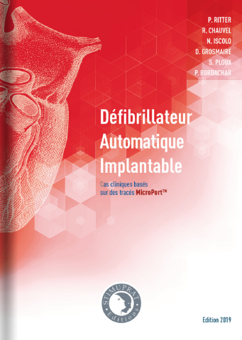 Défibrillateur Automatique Implantable basé sur les tracés Microport