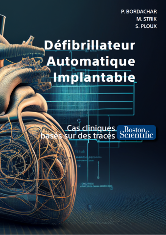 Défibrillateur Automatique Implantable Boston Scientific