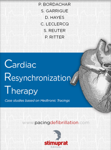 Medtronic Cardiac Resynchronization Therapy Medtronic Cardiac Resynchronization Therapy