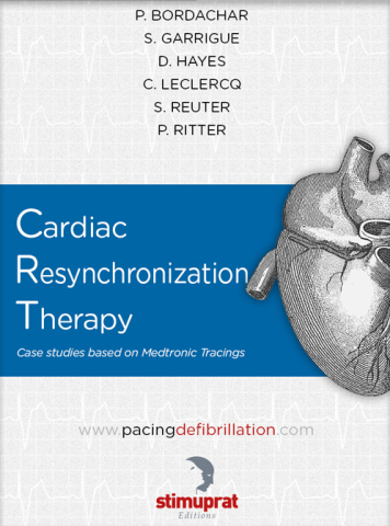 Medtronic Cardiac Resynchronization Therapy