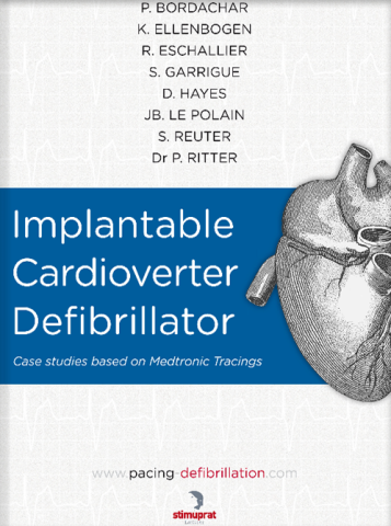 Medtronic Implantable Cardiac Defibrillator