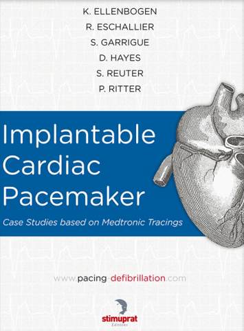 Medtronic Implantable Cardiac Pacemaker