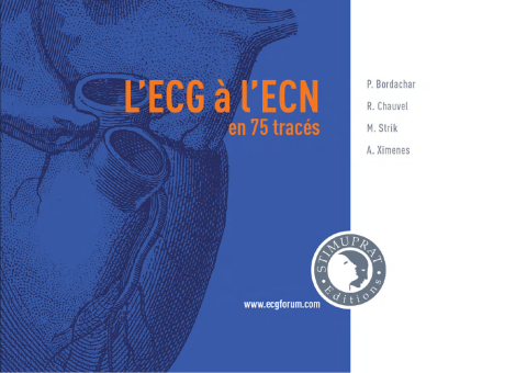 The ECG for the National Exam (ECN) in 75 tracings