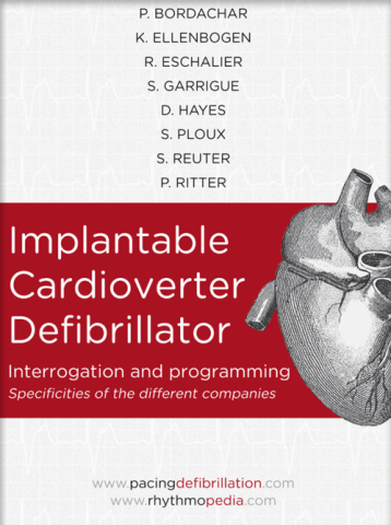 S.E.D.D. Implantable Cardioverter Defibrillator