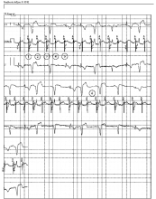 Cardiocases trace PDF