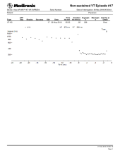 Cardiocases trace PDF