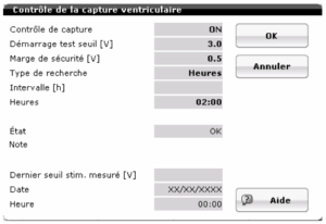 Pacemaker Ventricular Pacing | ECG Tracings | Cardiocases