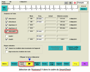 Pacemaker Ventricular Pacing | ECG Tracings | Cardiocases
